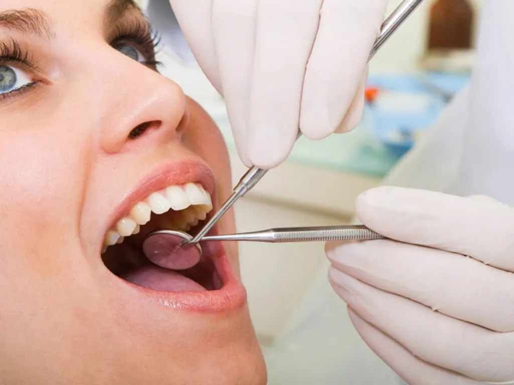 Schéma descriptif d’un implant dentaire montrant la vis implantée dans l’os, le pilier et la couronne dentaire.