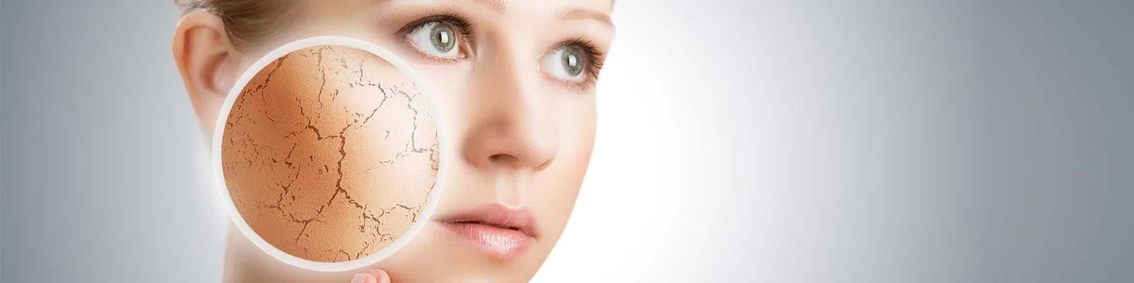 Femme appliquant délicatement une crème émolliente sur une plaque de psoriasis au niveau du bras.